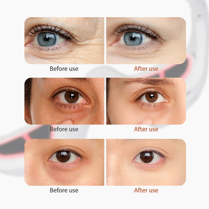 EyeRevive™ Red Massager